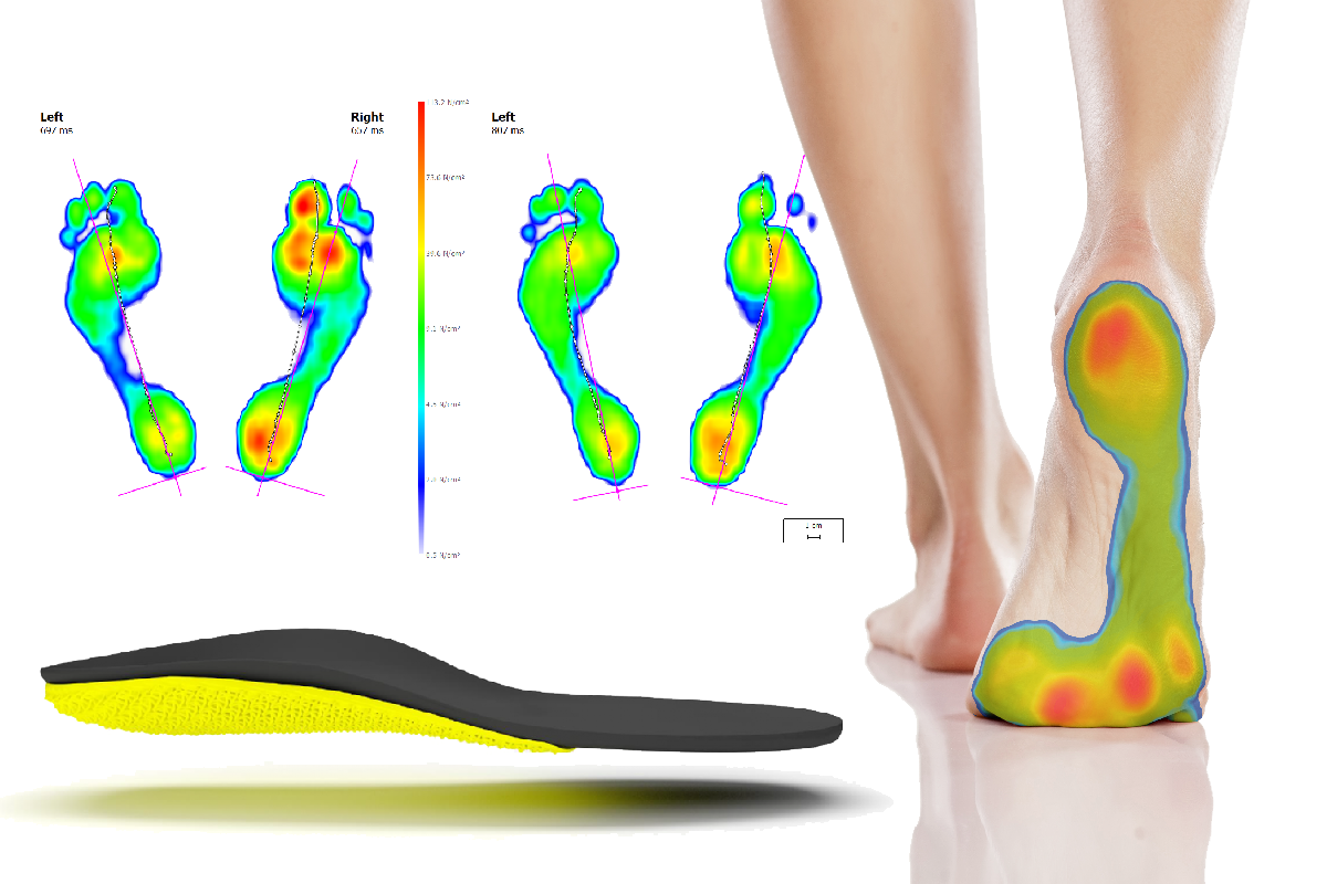 Bespoke Orthotics