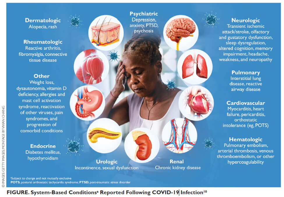 long covid symptoms